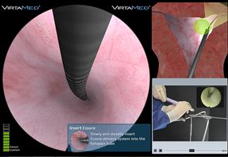 http://www.virtamed.com/files/2313/9583/6537/VirtaMed_HystSim_Essure_VirtaMed_web555.jpg