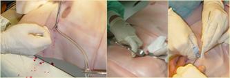 http://www.simulab.com/sites/default/files/page_images/TraumaManProcedures_v2.jpg?0